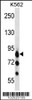 Western blot analysis in K562 cell line lysates (35ug/lane) .