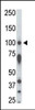 Antibody is used in Western blot to detect STK31 in rat testis tissue lysate.