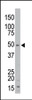 Antibody is used in Western blot to detect STK35 in mouse kidney tissue lysate.