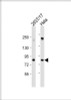 Western Blot at 1:1000 dilution Lane 1: 293T/17 whole cell lysate Lane 2: Hela whole cell lysate Lysates/proteins at 20 ug per lane.