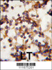 Formalin-fixed and paraffin-embedded human Lymph tissue reacted with Rictor antibody (N-term) , which was peroxidase-conjugated to the secondary antibody, followed by DAB staining.