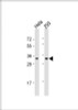 Western Blot at 1:1000 dilution Lane 1: Hela whole cell lysate Lane 2: 293 whole cell lysate Lysates/proteins at 20 ug per lane.