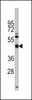 Western blot analysis of anti- in Y79 cell line lysates (35ug/lane) .