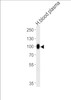 Western blot analysis of lysate from human blood plasma tissue lysate, using PLG Antibody at 1:1000 at each lane.