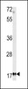 Western blot analysis of MFAP5 antibody in K562 cell line lysates (35ug/lane)