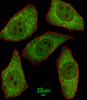 Immunofluorescent analysis of A549 cells, using MSRA Antibody . Antibody was diluted at 1:100 dilution. Alexa Fluor 488-conjugated goat anti-rabbit lgG at 1:400 dilution was used as the secondary antibody (green) . Cytoplasmic actin was counterstained with Dylight Fluor 554 (red) conjugated Phalloidin (red) .