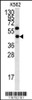 Western blot analysis of LYAR antibody in K562 cell line lysates (35ug/lane) .