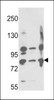 Western blot analysis of Neprilysin Antibody in A2058, A375, Ramos cell line lysates (35ug/lane)