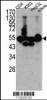 Western blot analysis of CPN1 antibody in K562, CEM, HEpG2 cell line lysates and mouse liver tissue lysates (35ug/lane)