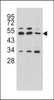 Western blot analysis of CPA4 antibody in Hela, CEM and NCI-H460 cell line lysates (35ug/lane)
