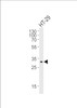 Western blot analysis of lysate from HT-29 cell line, using SMYD3 Antibody at 1:1000.