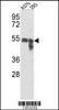 Western blot analysis of Tyrosinase Antibody in A375, 293 cell line lysates (35ug/lane)