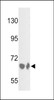 Western blot analysis of BF Antibody in HepG2 cell line and mouse liver tissue lysates (35ug/lane)