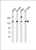 Western Blot at 1:1000 dilution Lane 1: A549 whole cell lysate Lane 2: DU145 whole cell lysate Lane 3: Hela whole cell lysate Lane 4: HT-1080 whole cell lysate Lysates/proteins at 20 ug per lane.