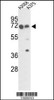 Western blot analysis of FKBP10 Antibody in A2058 and A375 cell line lysates (35ug/lane)