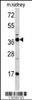 Western blot analysis of FBP1 antibody in mouse kidney tissue lysates (35ug/lane)