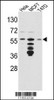 Western blot analysis of FKBP4 Antibody in Hela, MCF7, T47D cell line lysates (35ug/lane) .