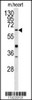 Western blot analysis of GGTLA1 antibody in mouse heart tissue lysates (35ug/lane)