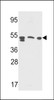 Western blot analysis in Y79, A2058, CEM cell line lysates (35ug/lane)