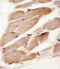 Formalin-fixed and paraffin-embedded human skeletal muscle reacted with PRKAA2 antibody, which was peroxidase-conjugated to the secondary antibody, followed by DAB staining.