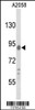 Western blot analysis of COG4 Antibody in A2058 cell line lysates (35ug/lane)