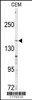 Western blot analysis of anti-ABCC4 Antibody in CEM cell line lysates (35ug/lane)