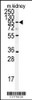 Western blot analysis of anti-ADAM9 Antibody in mouse kidney tissue lysates (35ug/lane)