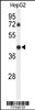 Western blot analysis of in HepG2 cell line lysates (35ug/lane)