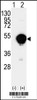 Western blot analysis of CYP20A1 using rabbit polyclonal CYP20A1 Antibody using 293 cell lysates (2 ug/lane) either nontransfected (Lane 1) or transiently transfected with the CYP20A1 gene (Lane 2) .