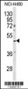 Western blot analysis of SERPINA4 antibody in NCI-H460 cell line lysates (35ug/lane)