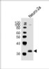 Western Blot at 1:1000 dilution + Neuro-2a whole cell lysates Lysates/proteins at 20 ug per lane.