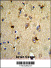 Formalin-fixed and paraffin-embedded human brain tissue reacted with EN2 Antibody, which was peroxidase-conjugated to the secondary antibody, followed by DAB staining.
