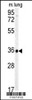 Western blot analysis of CA4 Antibody in mouse lung tissue lysates (35ug/lane)