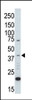 Western blot analysis of anti-ERK2 C-term Pab in UV-treated HL-60 cell lysate