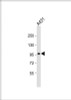 Western Blot at 1:500 dilution + A431 whole cell lysate Lysates/proteins at 20 ug per lane.