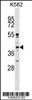 Western blot analysis in K562 cell line lysates (35ug/lane) .