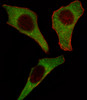 Fluorescent image of Hela cell stained with CDK4 Antibody .Hela cells were fixed with 4% PFA (20 min) , permeabilized with Triton X-100 (0.1%, 10 min) , then incubated with CDK4 primary antibody (1:25) . For secondary antibody, Alexa Fluor 488 conjugated donkey anti-rabbit antibody (green) was used (1:400) .Cytoplasmic actin was counterstained with Alexa Fluor 555 (red) conjugated Phalloidin (7units/ml) .CDK4 immunoreactivity is localized to Cytoplasm significantly.