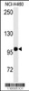 Western blot analysis of anti-HIPK2 Antibody (Y361) in NCI-H460 cell line lysates (35ug/lane)