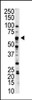 Western blot analysis of anti-NLK Pab in A375 cell lysate