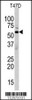 Western blot analysis of anti-ERK8 Antibody in T47D cell line lysates (35ug/lane)