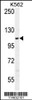 Western blot analysis in K562 cell line lysates (35ug/lane) .