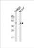 Western Blot at 1:2000 dilution Lane 1: SW620 whole cell lysates Lane 2: mouse liver lysates Lysates/proteins at 20 ug per lane.