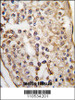 Formalin-fixed and paraffin-embedded human testis tissue reacted with PUM2 Antibody, which was peroxidase-conjugated to the secondary antibody, followed by DAB staining.