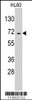 Western blot analysis of anti-EARS2 Pab in HL60 cell line lysates (35ug/lane)