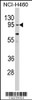 Western blot analysis of CLOCK Antibody in NCI-H460 cell line lysates (35ug/lane)