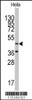 Western blot analysis of anti-NARS2 Antibody in Hela cell line lysates (35ug/lane) .