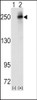 Western blot analysis of ALK using rabbit polyclonal ALK Antibody.293 cell lysates (2 ug/lane) either nontransfected (Lane 1) or transiently transfected with the ALK gene (Lane 2) .