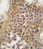 Formalin-fixed and paraffin-embedded human testis tissue reacted with ALK antibody, which was peroxidase-conjugated to the secondary antibody, followed by DAB staining.
