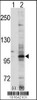 Western blot analysis of EPHA7 using EphA7 Antibody using 293 cell lysates (2 ug/lane) either nontransfected (Lane 1) or transiently transfected with the EPHA7 gene (Lane 2) .