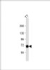 Western Blot at 1:1000 dilution + TT whole cell lysate Lysates/proteins at 20 ug per lane.